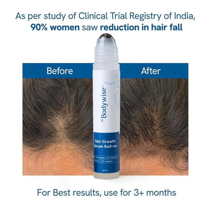 25Ml Hair Growth Essence Oil for Hair Care, Scalp Nourishment & Frizz Control 3% Rosemary Hair Serum